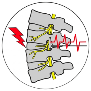 Schmerz & Neuromodulation